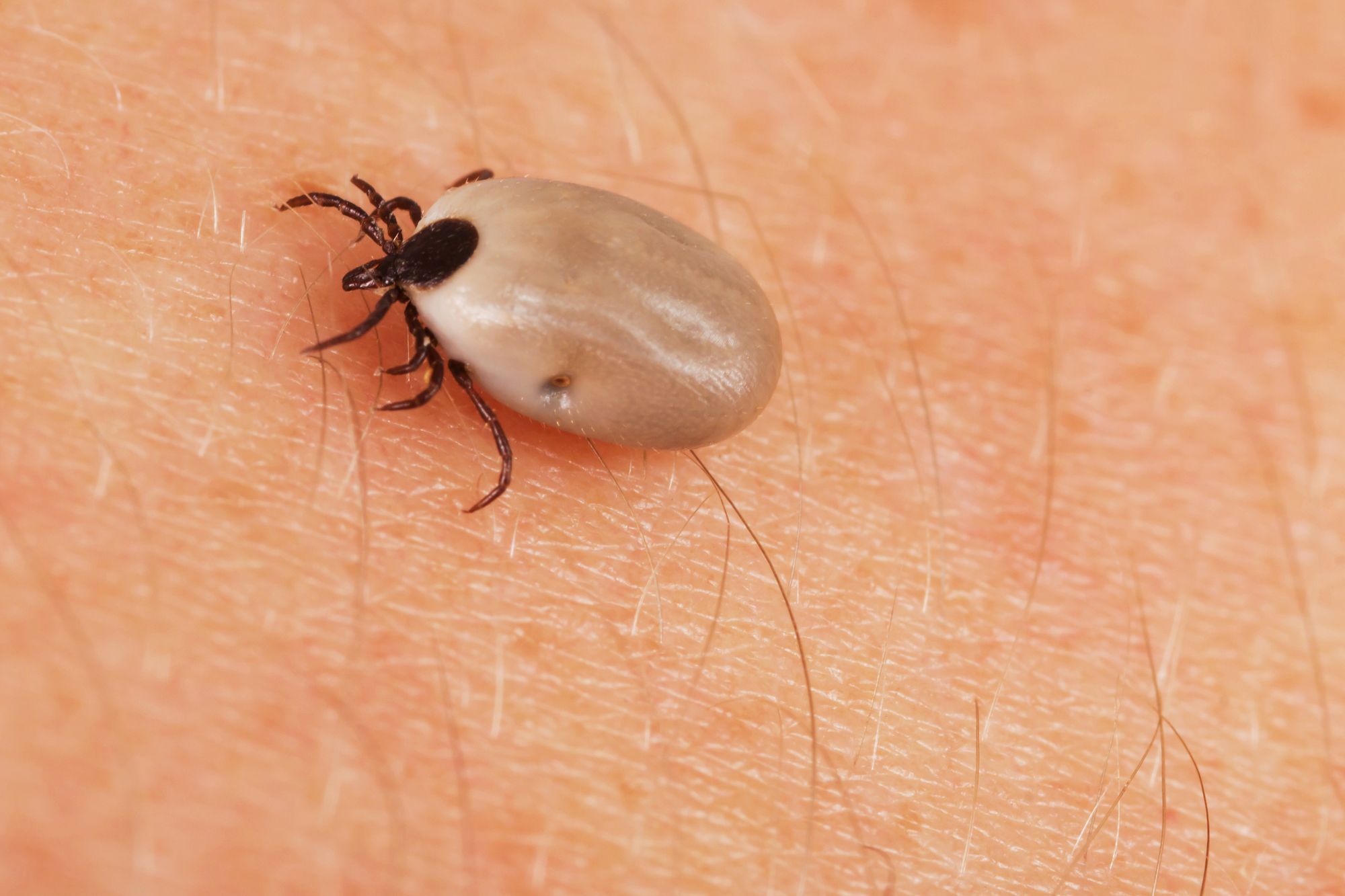                      A discussion about tick-borne illnesses                             
                     