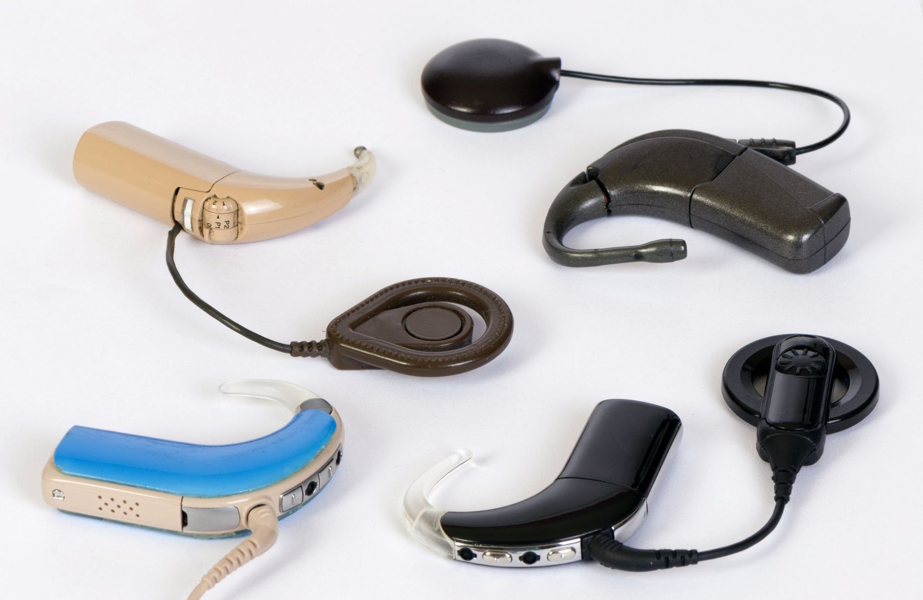 What is the benefit of cochlear implants over hearing aids?