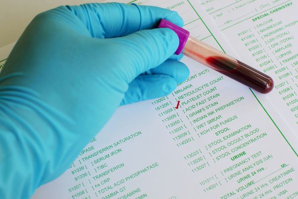 What causes a high platelet count?