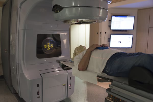 Using radiation therapy to treat brain tumours