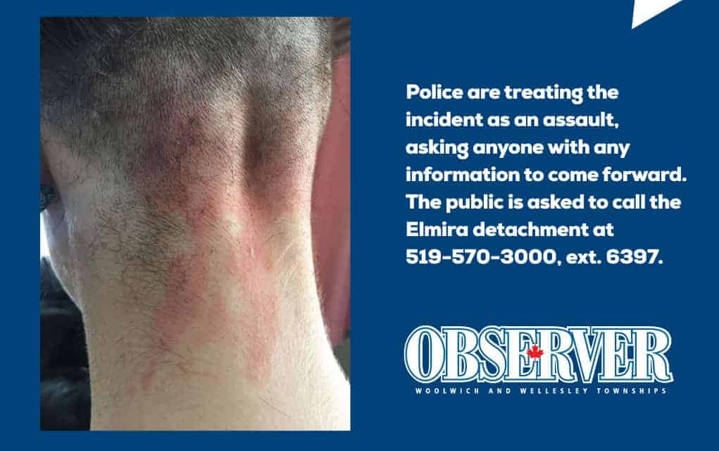 Elmira girl injured when hot coffee thrown from car; police investigating